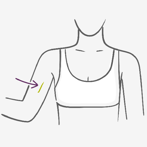 How to use Contraceptive Implant