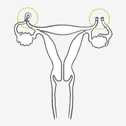 Sterilization Details