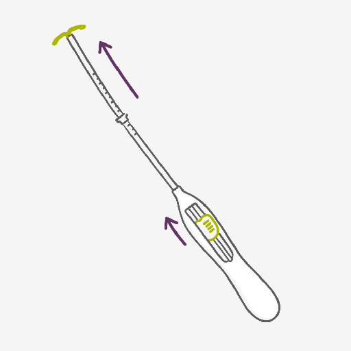 Sistema Intrauterino – Frenando en seco a los espermatozoides con el SIU